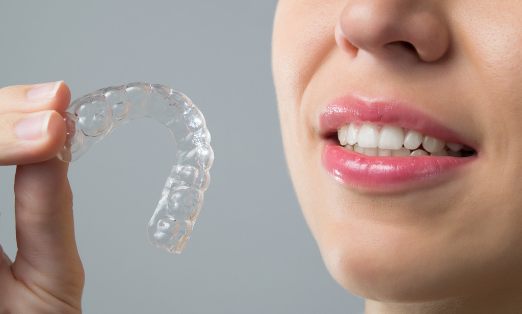 Best Ways to Avoid Invisalign Complications
