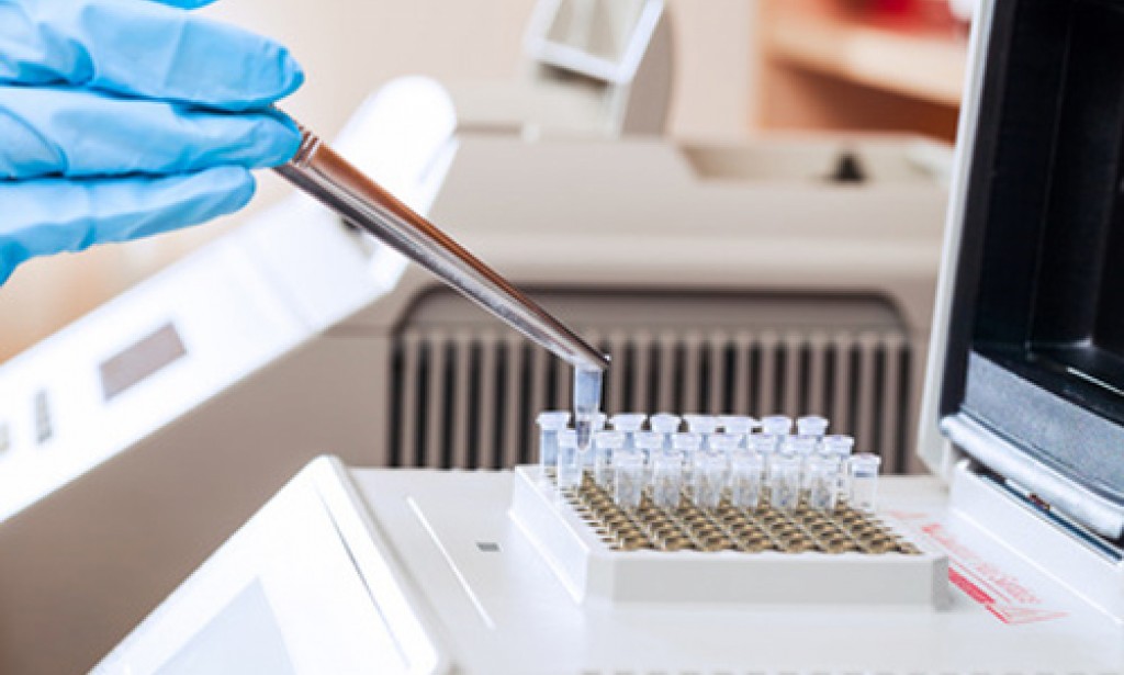 How Do Multiplex Cytokine Assays Explain Complex Diseases?